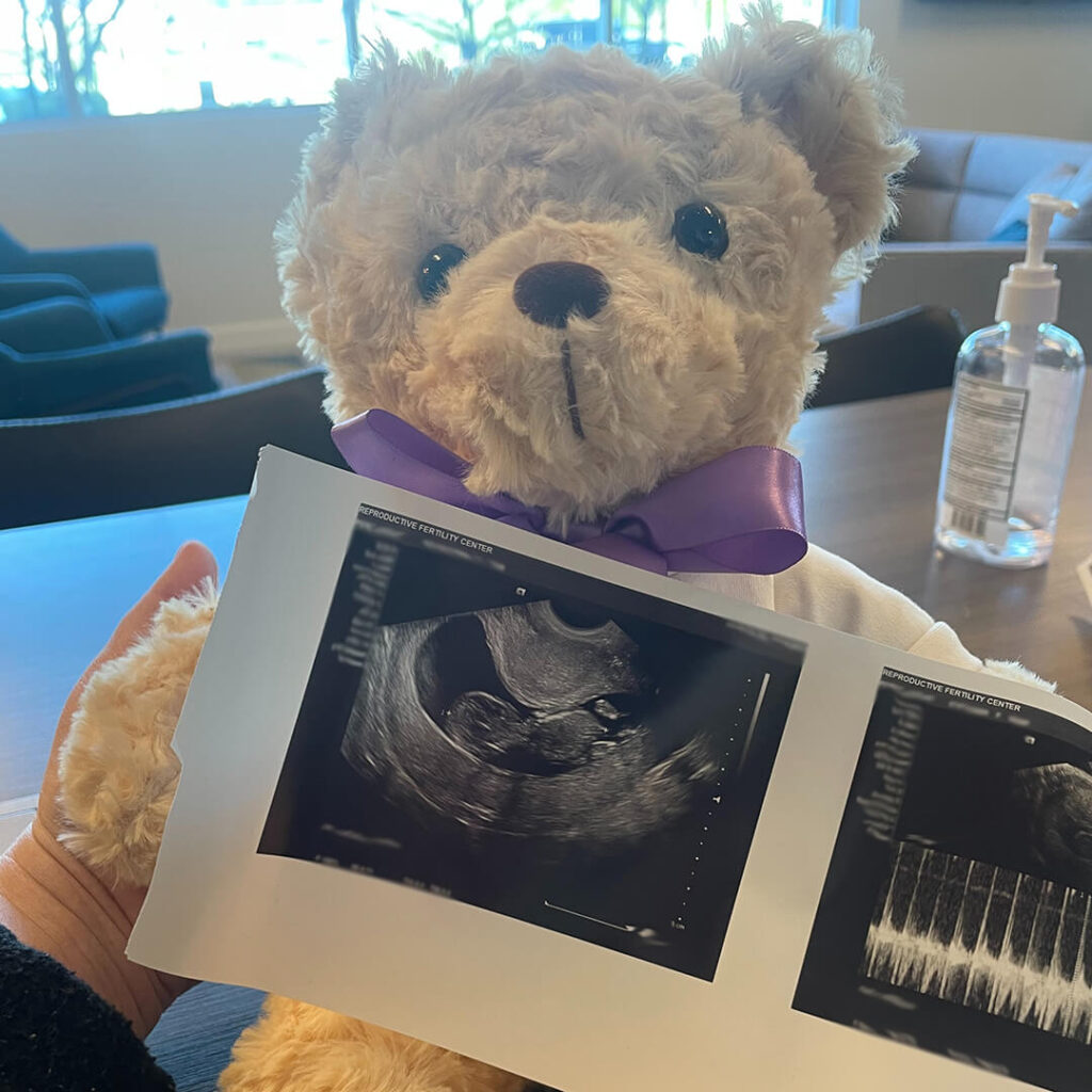 ultrasound scan of fetus in front of tan teddy bear with purple bow.